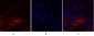 PKM2 Polyclonal Antibody